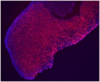 Hipfisis de ratn con las clulas somatotropas productoras de hormona del crecimiento teidas de rojo
