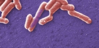 Cada año mueren en el mundo varias decenas de personas a causa de la infección por cepas verotoxigénicas de la bacteria Escherichia coli